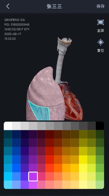 小智3D三维模型阅片app官方版