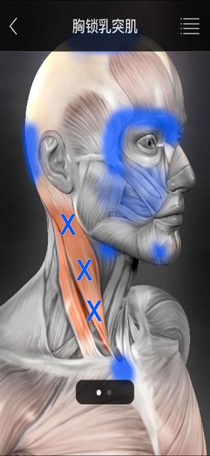 肌肉激痛点app安卓免费中文版下载2024