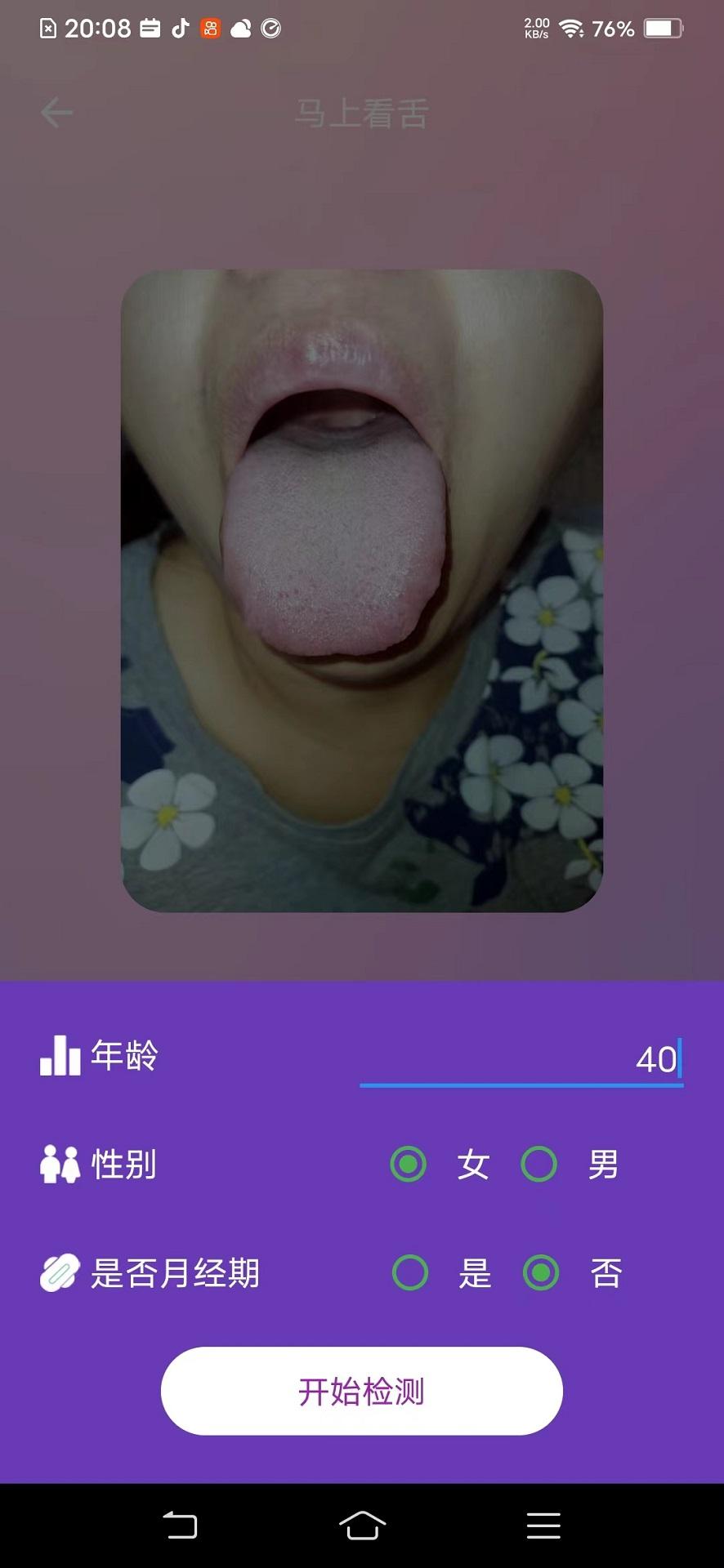 AI看舌app官方版