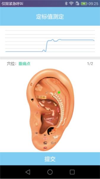 妙郎中耳穴检测图片